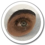 دعامة محجر العين