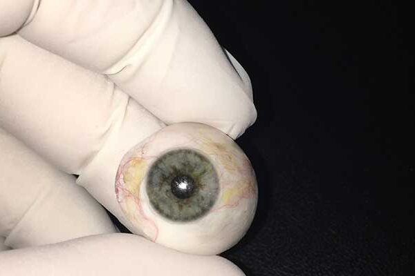 ما هي العين الاصطناعية؟