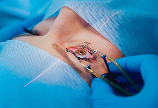 استئصال محتويات العين