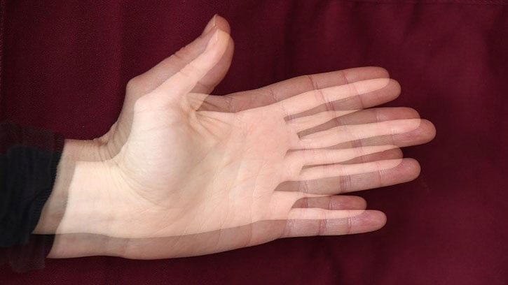 أعراض الساد