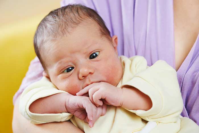 الحول (Strabismus)