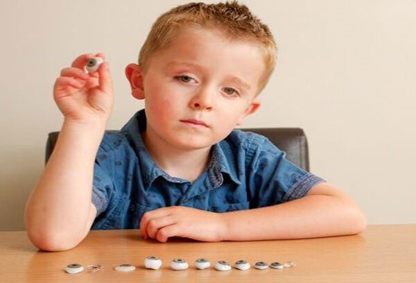 عيون الأطفال الاصطناعية